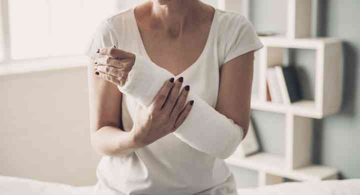 Woman holding her broken arm with cast